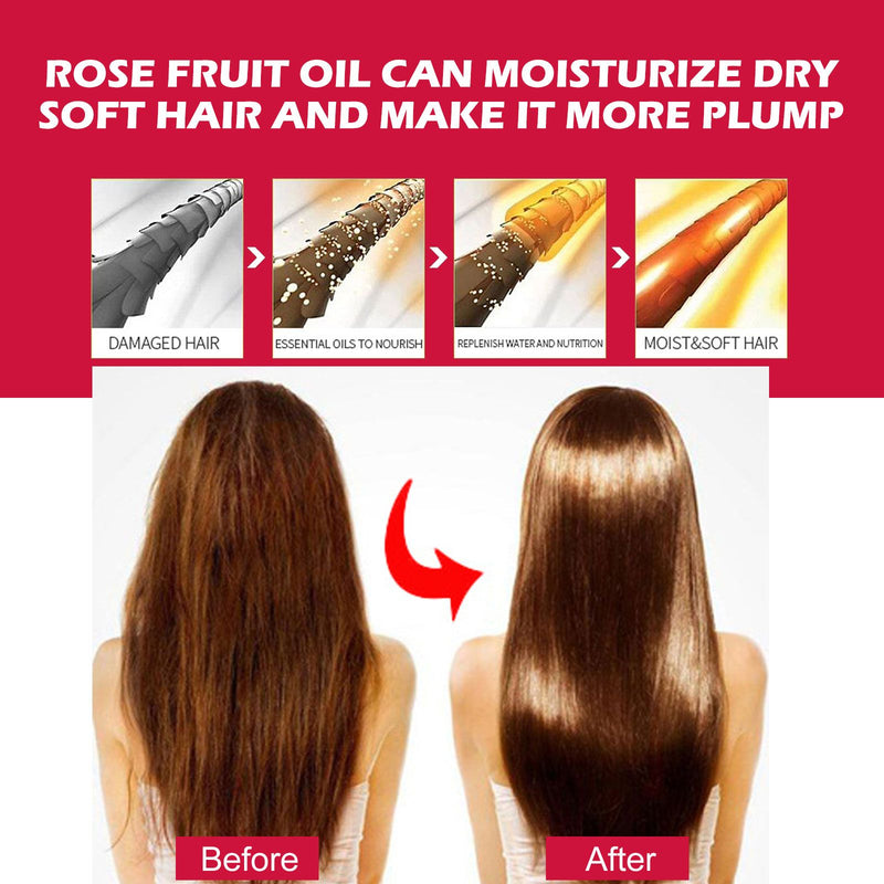 Rosehip Oil — Multi-Use Hydration for Face, Body & Hair