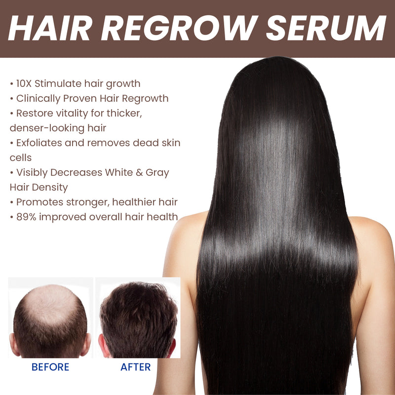 Nourishing Care for Thinning Hair — Hair Density Essence