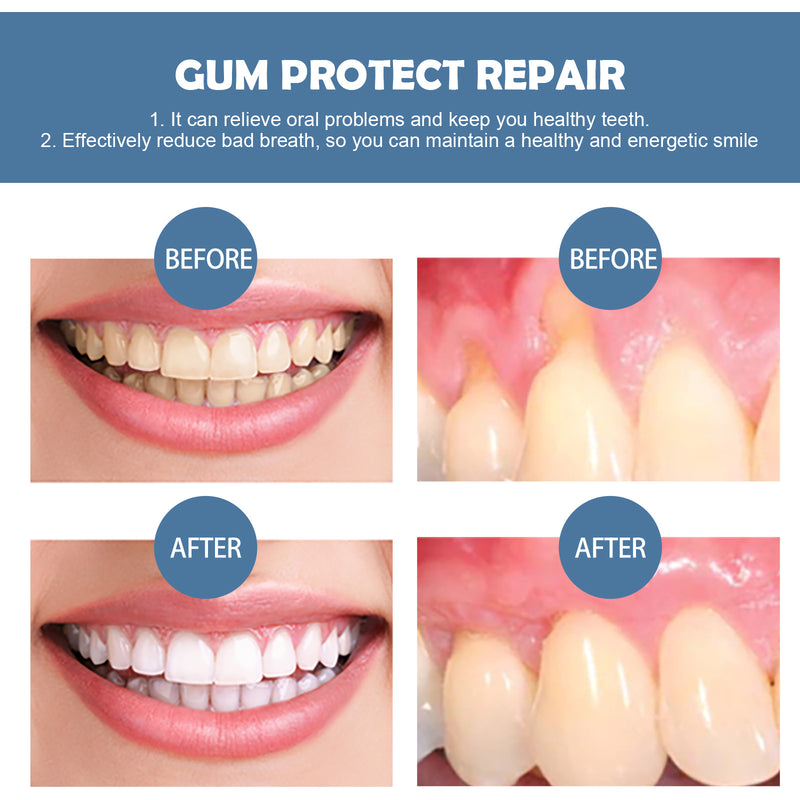 Gum Care & Stain Removal Kit — Healthier Gums, Brighter Smile