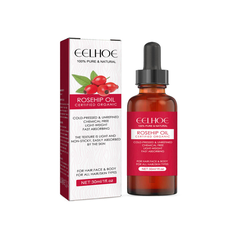 Rosehip Oil — Multi-Use Hydration for Face, Body & Hair