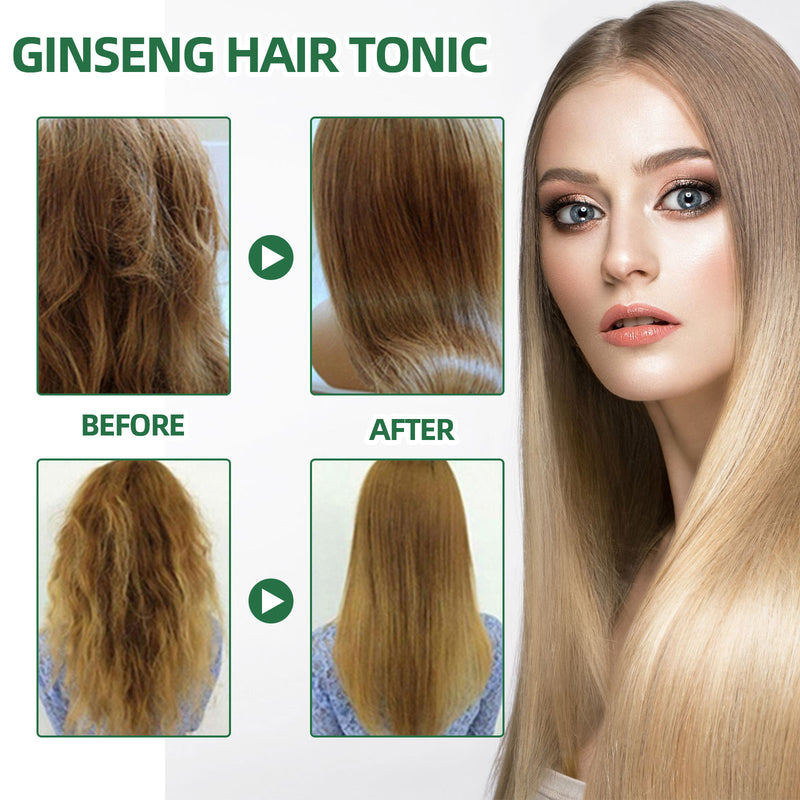 Ginseng Hair Growth Spray — Moisturizing Scalp Treatment