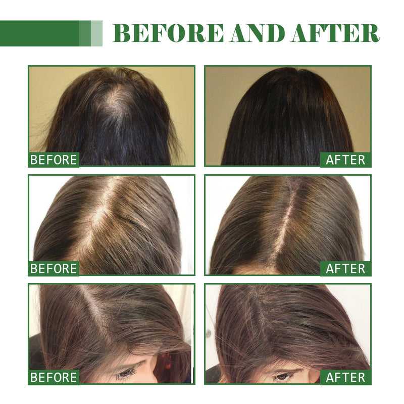 Nourishing Hair Repair Oil — Softens & Strengthens Strand by Strand