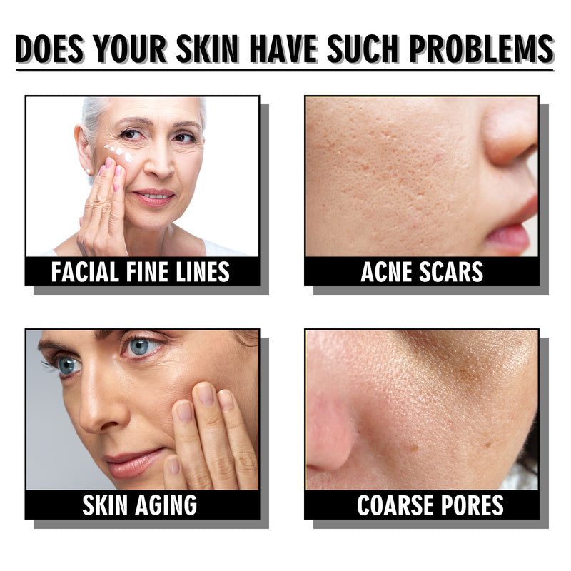 Snail Repair Cream — Fades Fine Lines, Firms & Replenishes Skin
