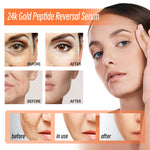 Hoygi 24k Gold Peptide Reversal Serum, Moisturizing Anti-wrinkle Firming And Anti-aging Essence