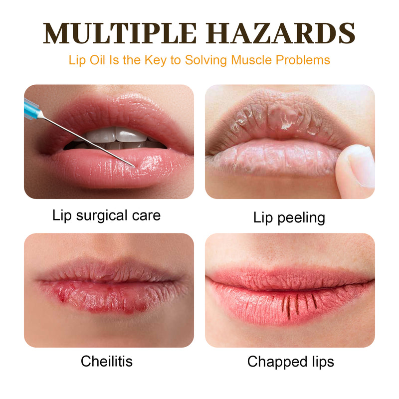 EELHOE Honey Lip Oil, Reduces Lip Lines, Prevents Cracking And Peeling, Moisturizing Lip Care Oil.