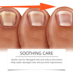 Ximonth Herbal Nail Care Solution Hand, Foot And Nail Cleansing And Repair Bright Nail Thick Toe Care Solution