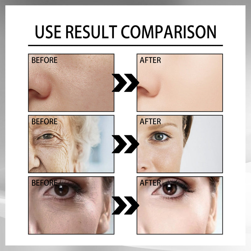 Snail Repair Cream — Fades Fine Lines, Firms & Replenishes Skin