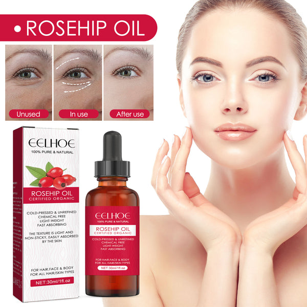 Rosehip Oil — Multi-Use Hydration for Face, Body & Hair