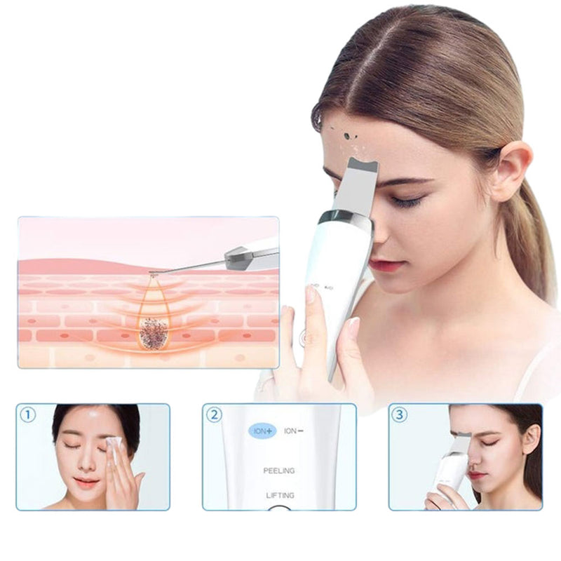 Ultrasonic Facial Skin Scrubber — Deep Pore Cleansing